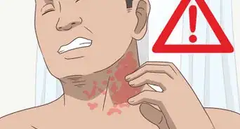 Treat Both Psoriatic Arthritis and Psoriasis