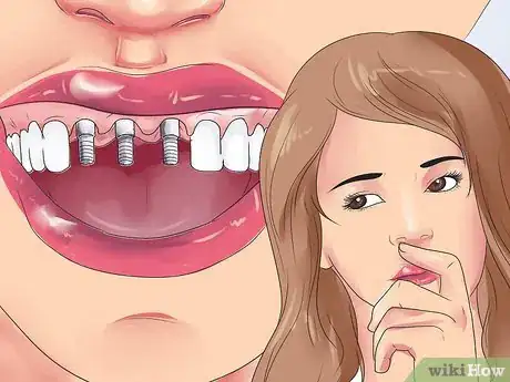 Image titled Handle Tooth Loss Step 11