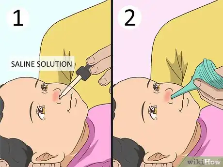 Image titled Treat an Infant Cold Step 4