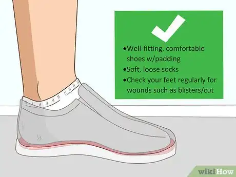 Image titled Cope with Neuropathy Step 15