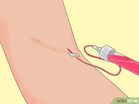 Image titled Balance Body pH Step 6