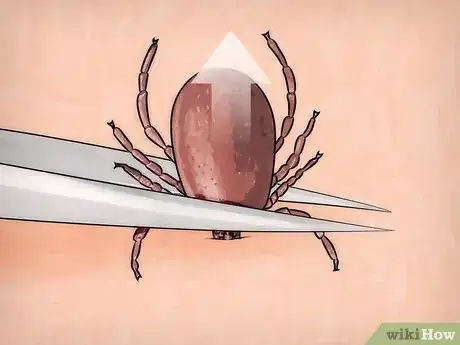 Image titled Kill Ticks Without Burning Them Step 11