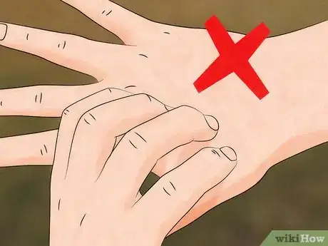 Image titled Prevent Chigger Bites Step 6