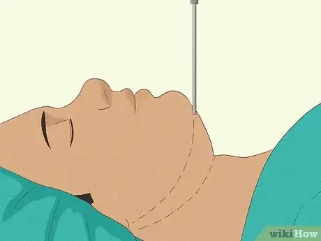 Image titled Get a Chiseled Jawline Step 16