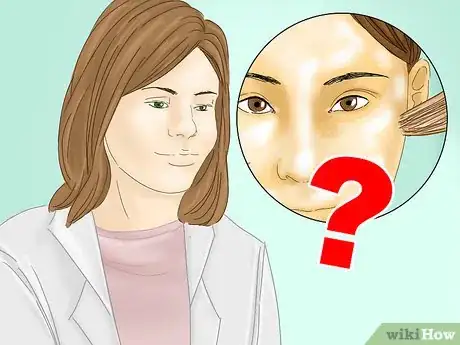 Image titled Get Rid of Blackheads and Whiteheads Using Commercial Products Step 7