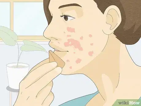 Image titled Wear Makeup when You Have Eczema Step 8