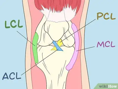 Image titled Repair Knee Ligament Damage Step 2