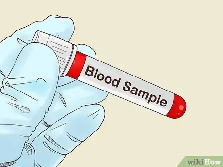 Image titled Diagnose Osteoarthritis Step 7