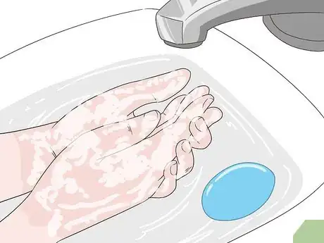 Image titled Treat Skin Picking Wounds Step 1