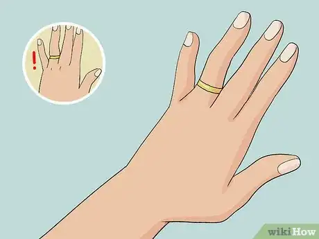 Image titled Get Rid of Chubby Hands Step 2
