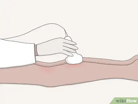 Image titled Diagnose and Treat Thrombophilia Step 4