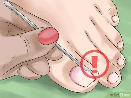 Image titled Keep Your Nails Healthy Step 14