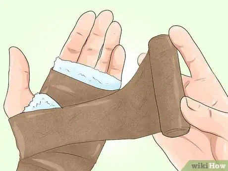 Image titled Treat Erythrodermic Psoriasis Step 4