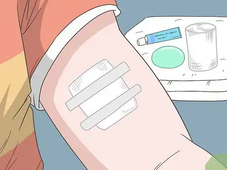 Image titled Treat Skin Picking Wounds Step 5