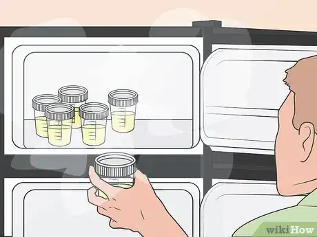 Image titled Test for M Protein Step 5