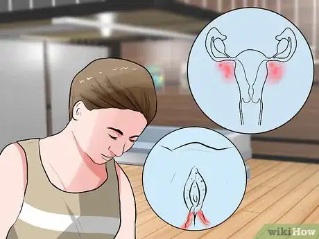 Image titled Recognize Vulva Cancer Symptoms Step 4