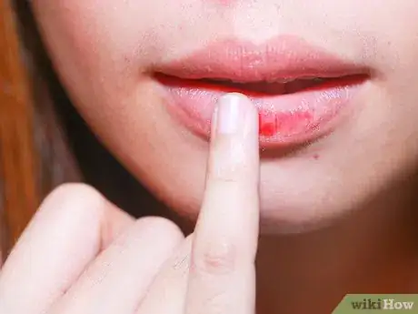 Image titled Lighten Dark Lips Step 6