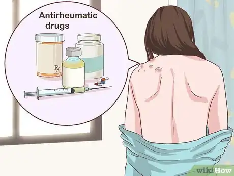 Image titled Handle a Rheumatoid Arthritis Skin Problem Step 6