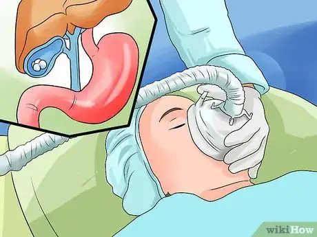 Image titled Differentiate Chronic Pancreatitis from Similar Conditions Step 14