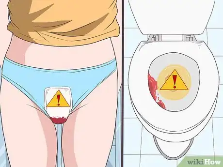 Image titled Recognize the Signs of a Postpartum Hemorrhage Step 3