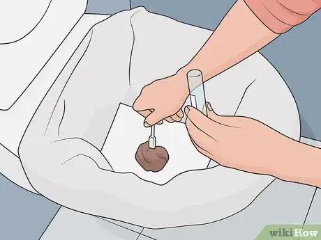 Image titled Store a Stool Sample Step 05