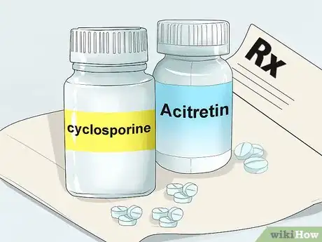 Image titled Treat Erythrodermic Psoriasis Step 7