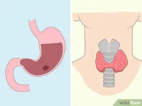 Image titled Use Ascorbic Acid Powder Step 2