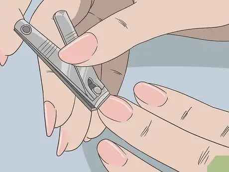 Image titled Treat Skin Disorders Caused by Psychological Problems Step 12