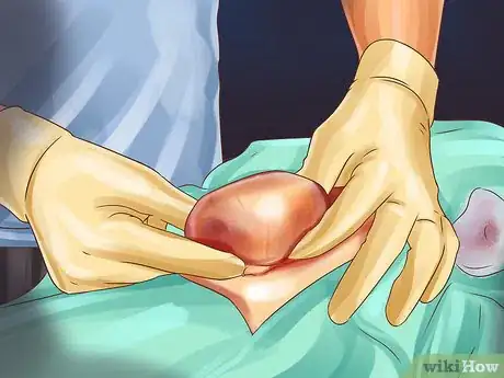 Image titled Treat Feline Intestinal Lymphoma Step 7