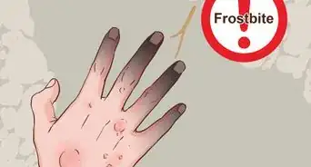 Prepare for Winter Camping