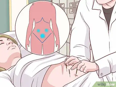 Image titled Treat Fibromyalgia with Acupuncture Step 9
