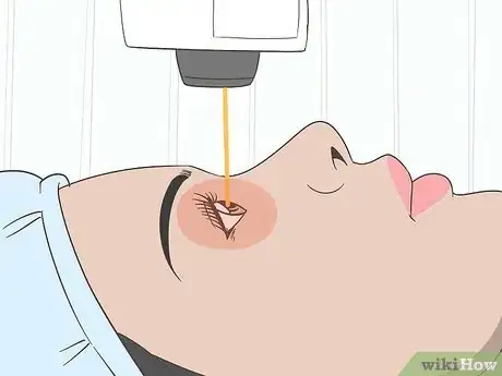 Image titled Prevent Myopia from Worsening Step 4