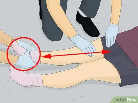 Image titled Make a Traction Splint for a Fractured Femur Step 2