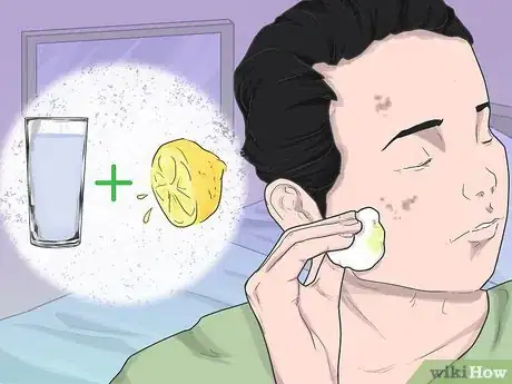 Image titled Cover Dark Spots on Your Face Step 11