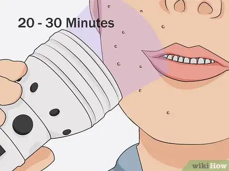 Image titled Use Blue Light Acne Treatment Step 08