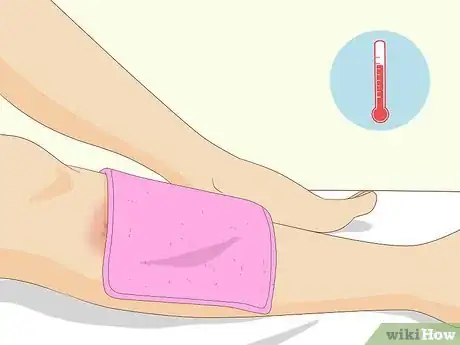 Image titled Soothe Itchy Legs Step 22