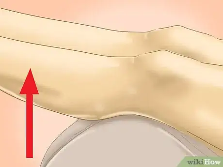 Image titled Ease Pain Caused by a Stress Fracture Step 3