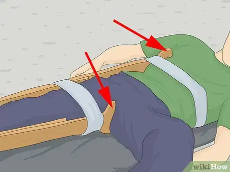 Image titled Make a Traction Splint for a Fractured Femur Step 4