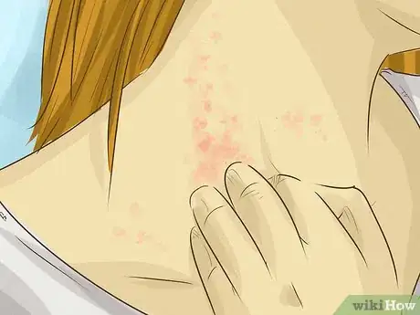 Image titled Diagnose Liver Cancer Step 7