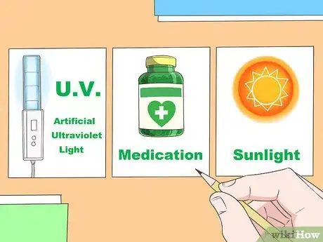 Image titled Care for Psoriasis Step 7