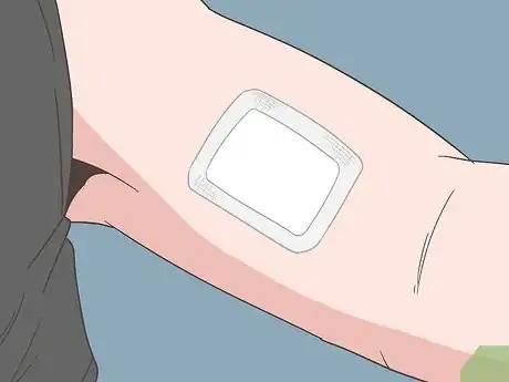 Image titled Treat Skin Picking Wounds Step 4