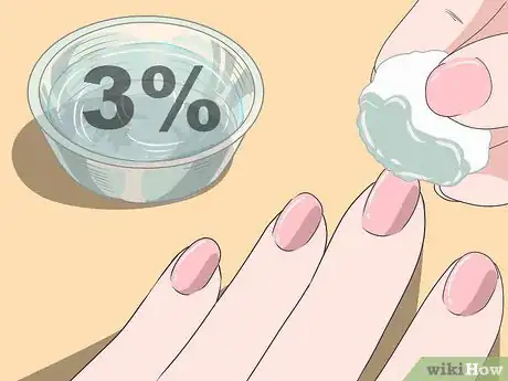 Image titled Use Hydrogen Peroxide Step 1