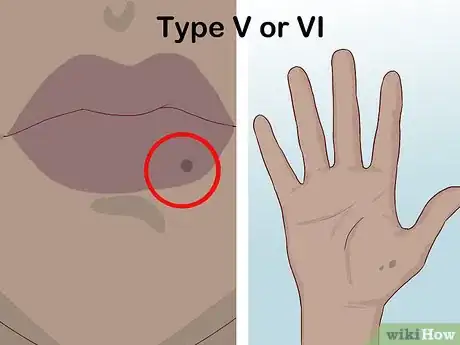 Image titled Determine Fitzpatrick Skin Type Step 15