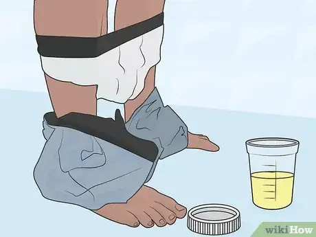 Image titled Test for M Protein Step 4