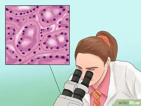 Image titled Stage Lung Cancer Step 15