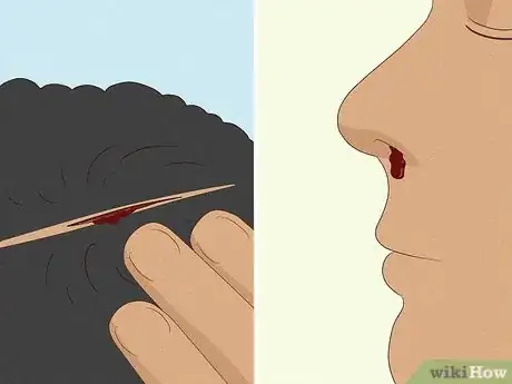 Image titled Identify Symptoms of a Head Injury Step 2