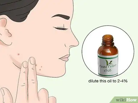 Image titled Use Herbs to Treat Acne Step 1