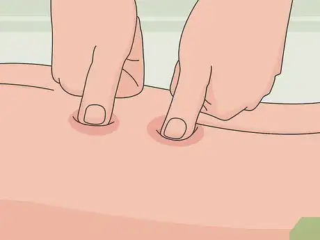 Image titled Deal with Liver Cancer Pain Step 8