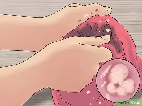 Image titled Wash Baby Clothes Step 10