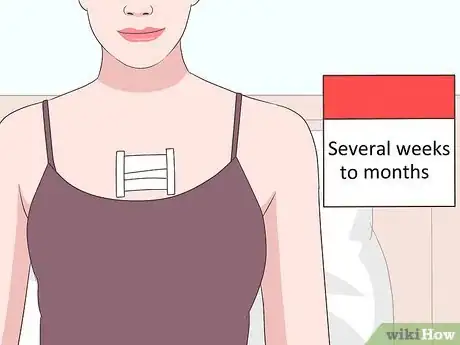 Image titled Treat Myasthenia Gravis Step 10